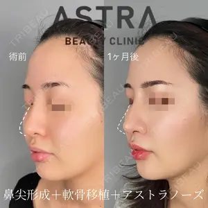 ASTRA BEAUTY CLINIC 塩満 惠子医師の症例