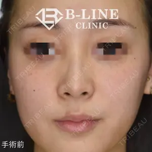 B-LINE CLINIC 池袋院 小池 康弘医師の症例