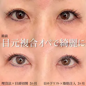 東京シンデレラ美容外科 池袋院の症例
