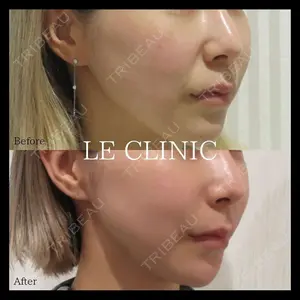 LE CLINICの症例