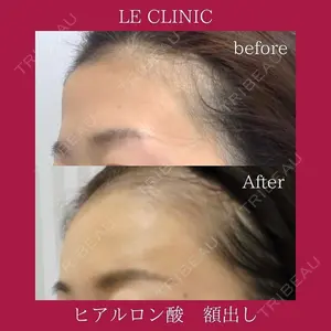 LE CLINICの症例