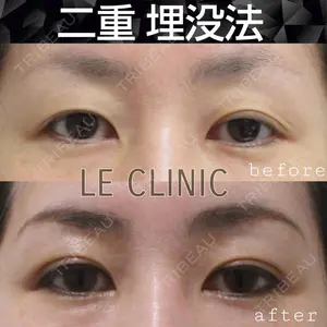 LE CLINIC 喜多　俊博医師の症例