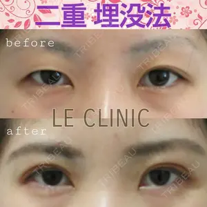 LE CLINIC 喜多　俊博医師の症例