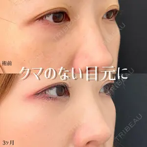 東京シンデレラ美容外科 池袋院の症例