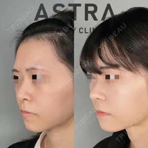 ASTRA BEAUTY CLINIC 塩満 惠子医師の症例