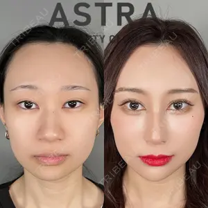 ASTRA BEAUTY CLINICの症例