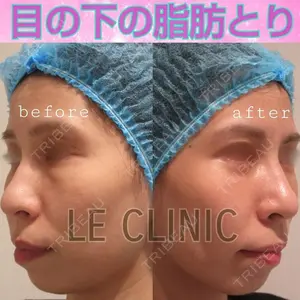 LE CLINIC 喜多　俊博医師の症例