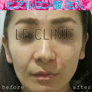 LE CLINIC 喜多　俊博医師の症例