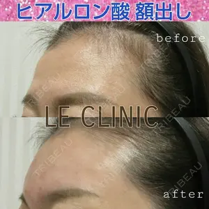 LE CLINIC 喜多　俊博医師の症例