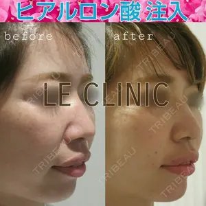 LE CLINIC 喜多　俊博医師の症例