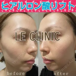 LE CLINIC 喜多　俊博医師の症例