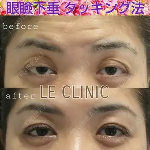 LE CLINIC 喜多　俊博医師の症例