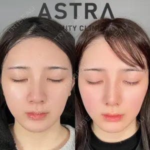 ASTRA BEAUTY CLINIC 塩満 惠子医師の症例