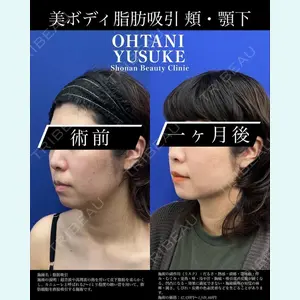 湘南美容クリニック 横浜東口院の症例