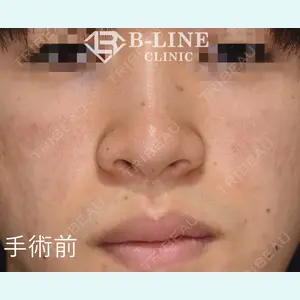 B-LINE CLINIC 池袋院 小池 康弘医師の症例