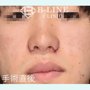 B-LINE CLINIC 池袋院 小池 康弘医師の症例