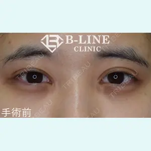 B-LINE CLINIC 池袋院 小池 康弘医師の症例