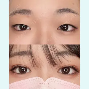 ASTRA BEAUTY CLINIC 塩満 惠子医師の症例