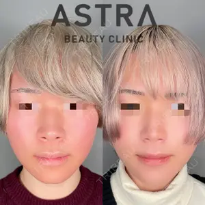 ASTRA BEAUTY CLINICの症例