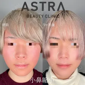 ASTRA BEAUTY CLINICの症例