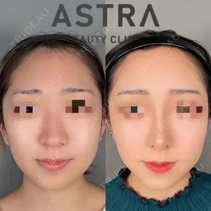 ASTRA BEAUTY CLINIC 塩満 惠子医師の症例