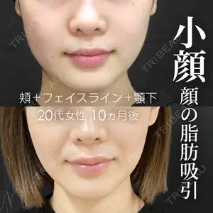 症例