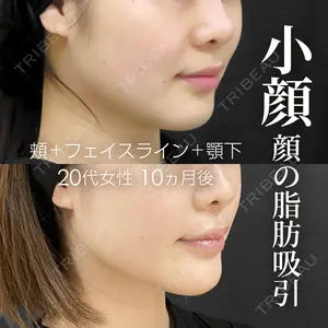 症例
