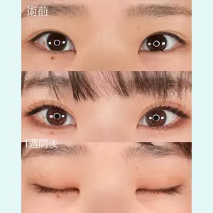 ASTRA BEAUTY CLINIC 塩満 惠子医師の症例