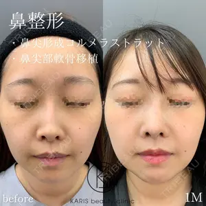 KARIS beauty clinic 滝内 ヒロフミ医師の症例