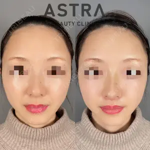 ASTRA BEAUTY CLINICの症例