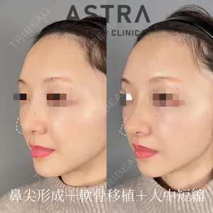 ASTRA BEAUTY CLINICの症例