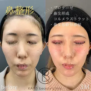 KARIS beauty clinicの症例