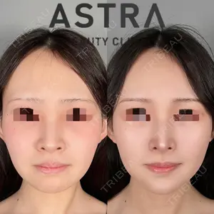 ASTRA BEAUTY CLINIC 塩満 惠子医師の症例