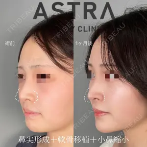 ASTRA BEAUTY CLINIC 塩満 惠子医師の症例