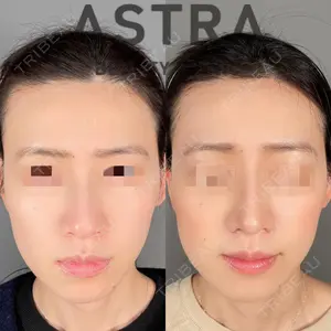 ASTRA BEAUTY CLINIC 塩満 惠子医師の症例