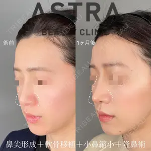 ASTRA BEAUTY CLINIC 塩満 惠子医師の症例