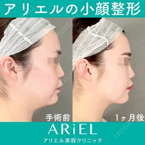 アリエル美容クリニック 大宮院 鈴木　桂介医師の症例