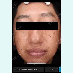 DMTC美容皮膚科 日本橋院の症例