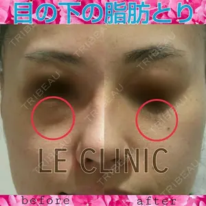 LE CLINIC 喜多　俊博医師の症例