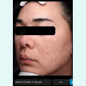 DMTC美容皮膚科 日本橋院の症例