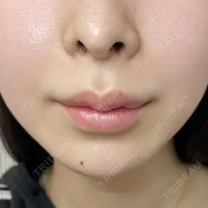 ルラ美容クリニック 大宮院 / ルラスキンクリニック 大宮院の症例