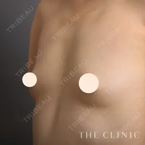 THE CLINIC（ザ・クリニック）東京院 加藤 敏次医師の症例