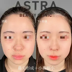 ASTRA BEAUTY CLINIC 塩満 惠子医師の症例