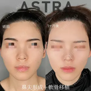 ASTRA BEAUTY CLINIC 塩満 惠子医師の症例