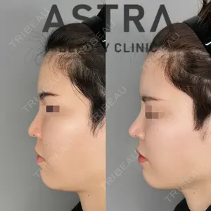 ASTRA BEAUTY CLINIC 塩満 惠子医師の症例