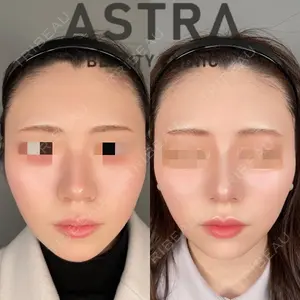 ASTRA BEAUTY CLINIC 塩満 惠子医師の症例