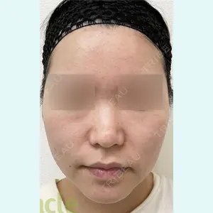 オラクル美容皮膚科 名古屋院の症例