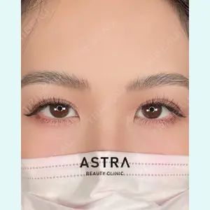 ASTRA BEAUTY CLINICの症例