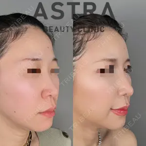 ASTRA BEAUTY CLINIC 塩満 惠子医師の症例