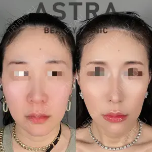 ASTRA BEAUTY CLINIC 塩満 惠子医師の症例